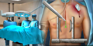 Mejores 8 juegos de cirugía para Android