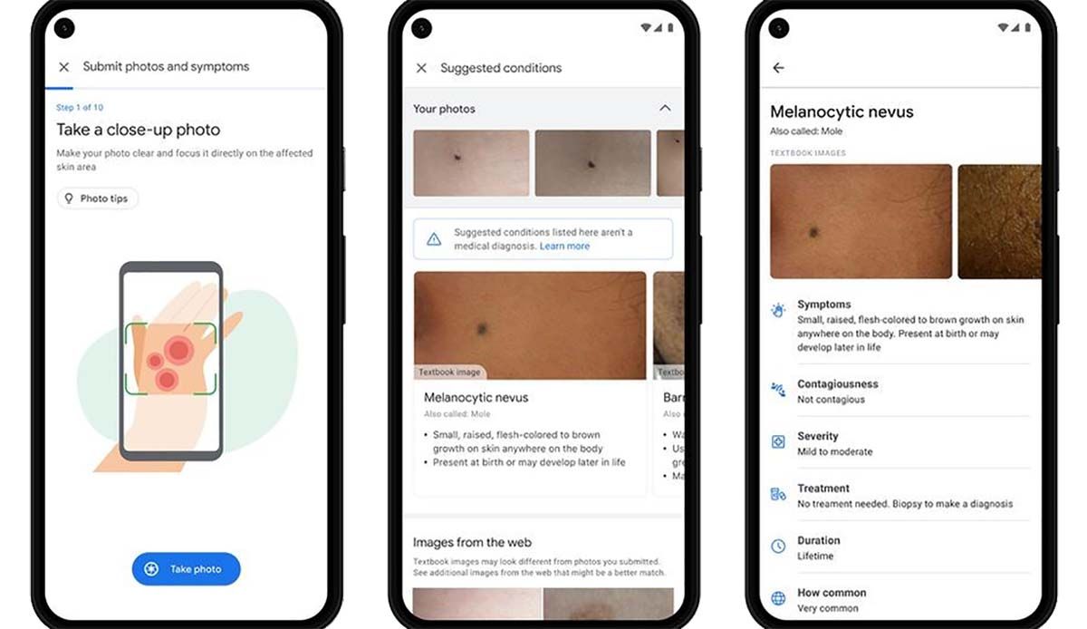 detectar enfermedades piel uñas cabello con google app IA usando la camara del movil